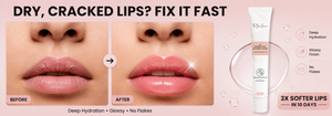 Best Lip Pigmentation Brightening Bundle - Exfoliate + Treat