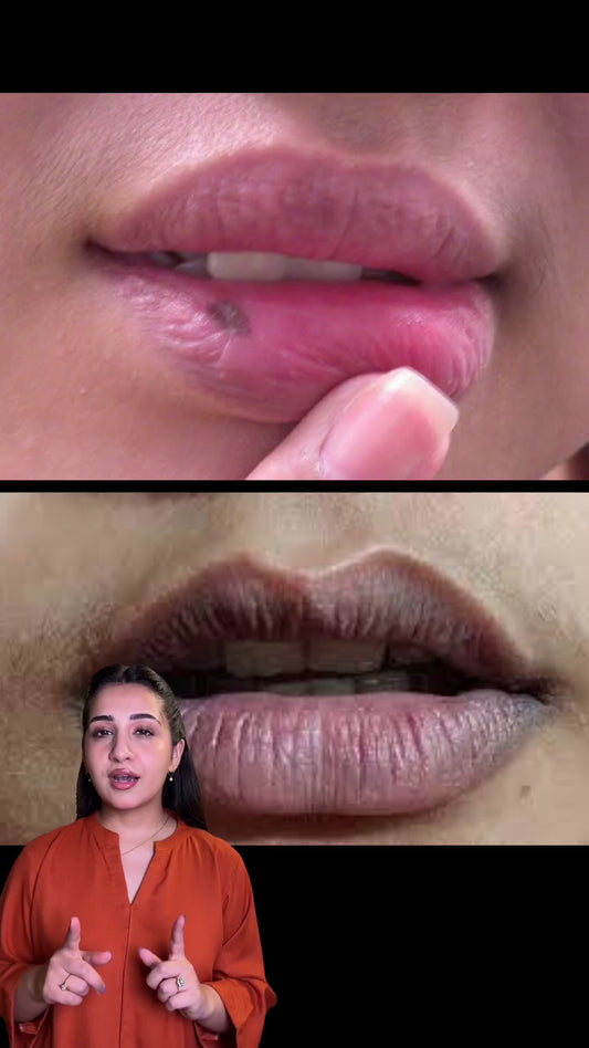 Azadi Bundle - Pack of 2 Lip Pigmentation Cream