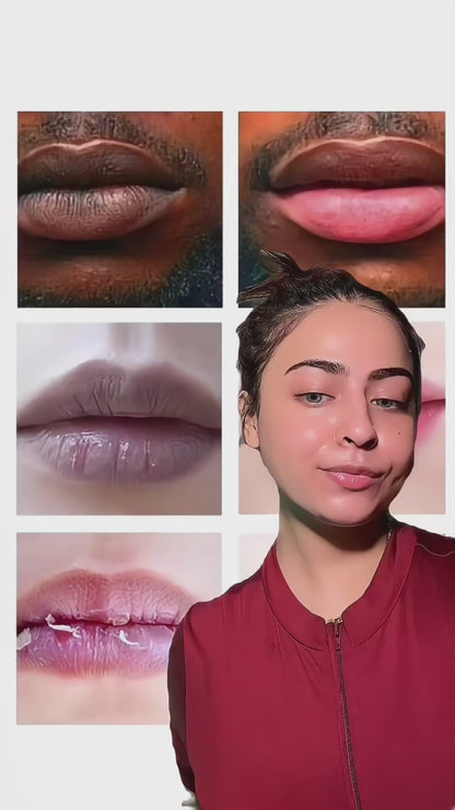Advance Lip Pigmentation Cream💋 - Buy 1 Get 1 FREE